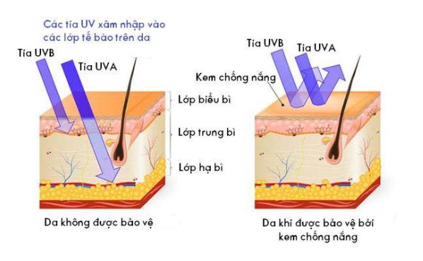Hieu-Het-Cac-Thuat-Ngu-De-Chon-Kem-Chong-Nang-Phu-Hop-1