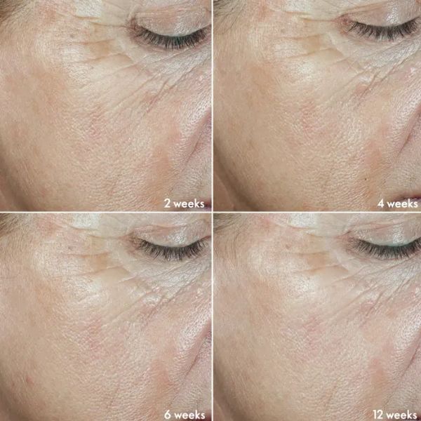 bo-novage-ecollagen-4 bo-novage-ecollagen-4